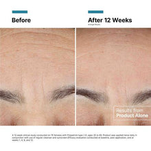 Load image into Gallery viewer, Advanced RGN-6