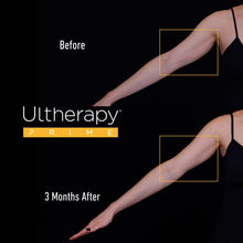 Load image into Gallery viewer, Ultherapy PRIME® Arms