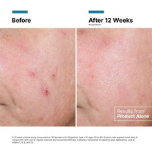 Load image into Gallery viewer, Advanced RGN-6
