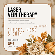 Vein Therapy — Cheeks + Nose + Chin