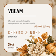 Vbeam® - Cheeks & Nose